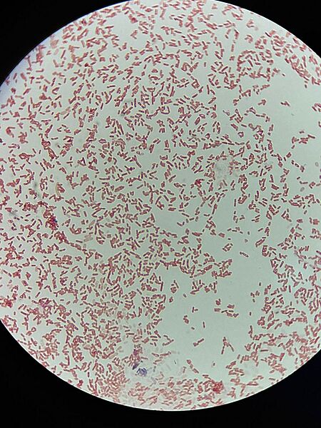 Bacteria gram negativa, Escherichia coli