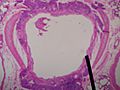 Bronchi