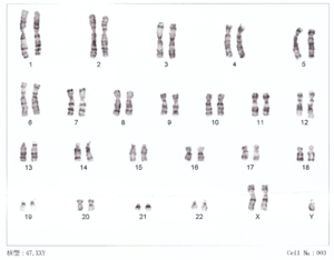Human chromosomesXXY01.png