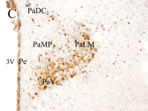 Archivo:Nucleo Paraventric Parv Magn