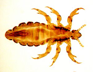 Archivo:Fig. 1. Male of head louse