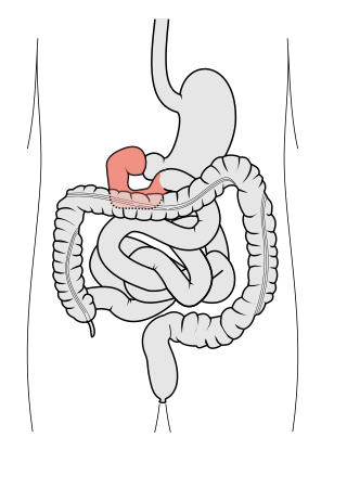 Tractus intestinalis duodenum.svg