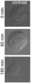 Celula Dendritica MOContrast