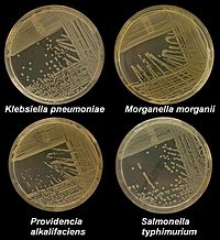 Archivo:K pneumoniae M morganii providencia styphimuriuma