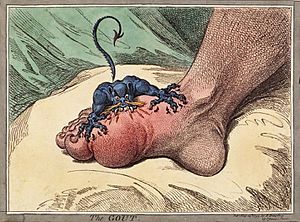 Archivo:The gout james gillray