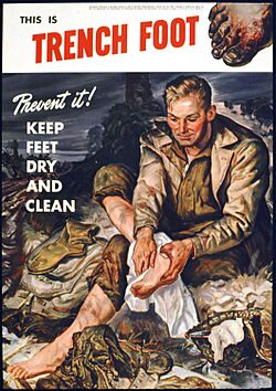 Archivo:THIS IS TRENCH FOOT. PREVENT IT^ KEEP FEET DRY AND CLEAN - NARA - 515785