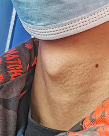 Adam's apple 50.jpg