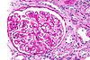 Membranous nephropathy - pas - very high mag.jpg