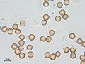 Symphytocarpus flaccidus - myxoflagellates