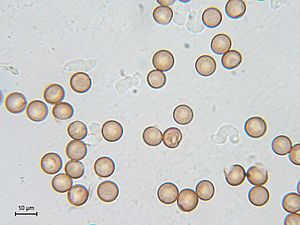Archivo:Symphytocarpus flaccidus - myxoflagellates