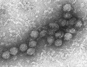 Archivo:West Nile virus EM PHIL 2290 lores