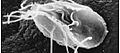 Giardia lamblia