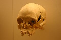 Lapa Vermelha IV Hominid 1-Homo Sapiens 11,500 Years Old.jpg