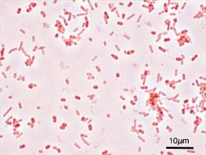 Archivo:Salmonella Typhimurium Gram