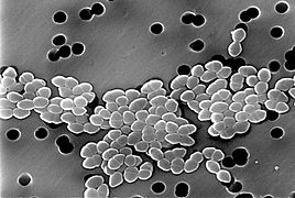 Vancomycin-Resistant Enterococcus 01