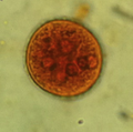 Entaemoeba coli cyst 6 nuclei