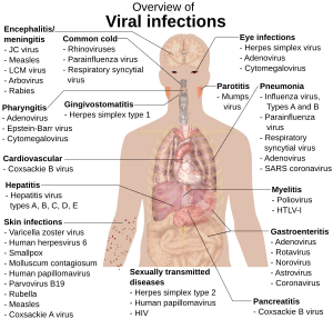Archivo:Viral infections and involved species