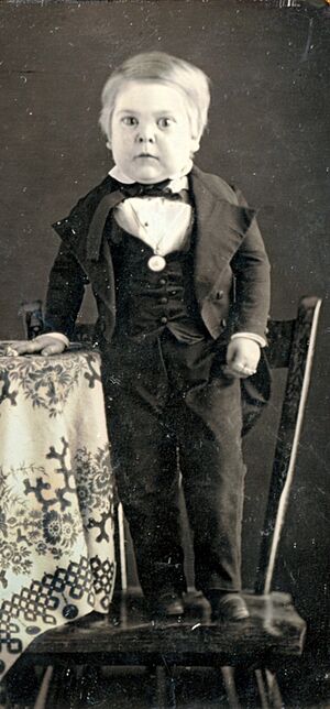 Archivo:Charles Sherwood Stratton - dagurreotype circa 1848