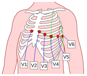 Precordial Leads 3