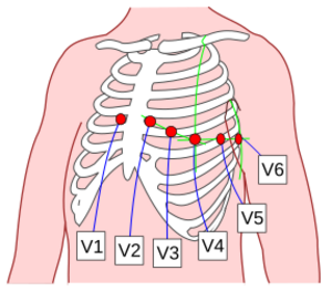 Archivo:Precordial Leads 3