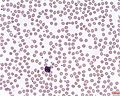 A type of white cell (Basophil)