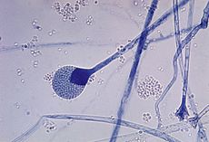 Archivo:Mature sporangium of a Mucor sp. fungus