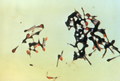 Clostridium tetani 01