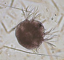 Archivo:Polychaeta gen. sp., metatrochophore 1