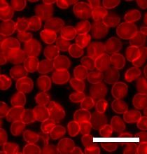 Archivo:Sedimented red blood cells