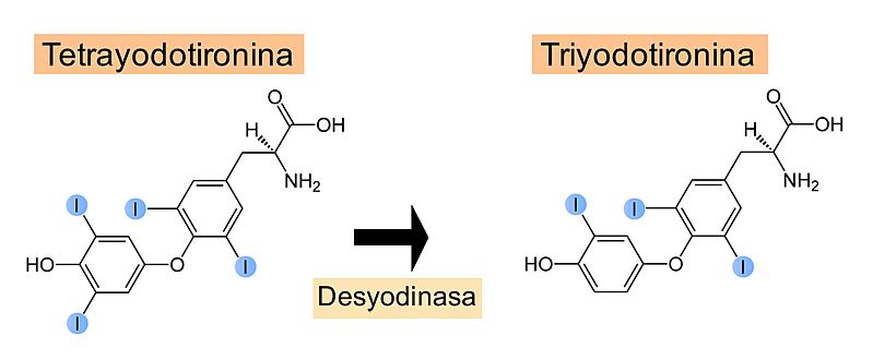 Desyodinasa