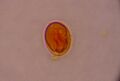 Giardia cyst