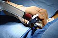 Bone marrow biopsy