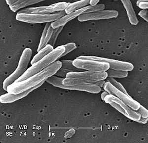 Archivo:Mycobacterium tuberculosis