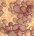 Amiloplastos de células de papa