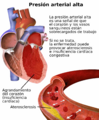 Blausen 0486 HighBloodPressure 01-es
