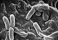 Pseudomonas aeruginosa SEM