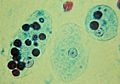 Trophozoites of Entamoeba histolytica with ingested erythrocytes