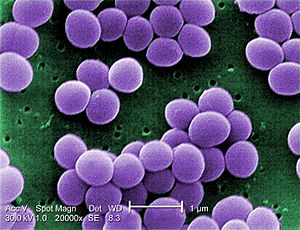 Archivo:Staphylococcus aureus VISA 2