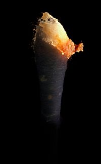 Cerumen para Niños