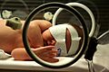 Jaundice phototherapy