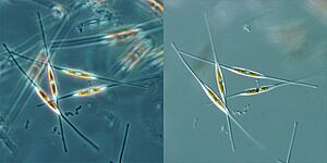 Archivo:Diatoms PhC DIC