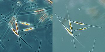 Diatoms PhC DIC