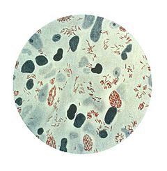 Archivo:Mycobacterium leprae