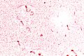 Vibrio cholerae 01