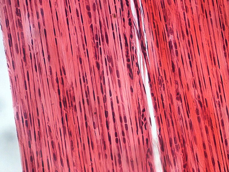 Dense connective tissue-400x