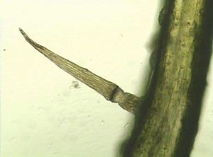 Archivo:Dionaea-muscipula-Ausloeseborste-Mikroskopaufnahme
