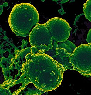 Archivo:Neutrophil and Methicillin-resistant Staphylococcus aureus (MRSA) Bacteria