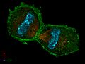 3D-SIM-4 Anaphase 3 color