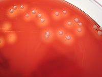 Archivo:Staphylococcus aureus agar sangre, acercamiento