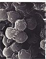 Bodo caudatus cysts x12,000 Scanning EM